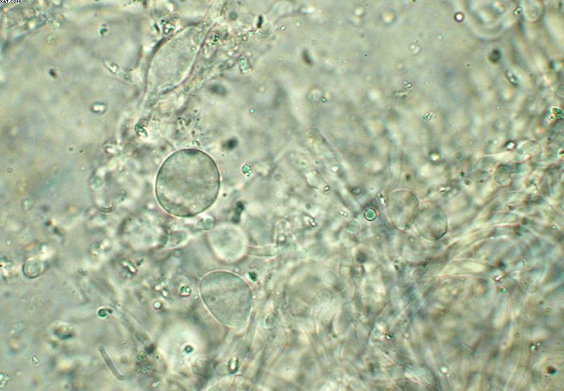 Clitocybe phaeophthalma var. gibboides (Raithelh.) Bon